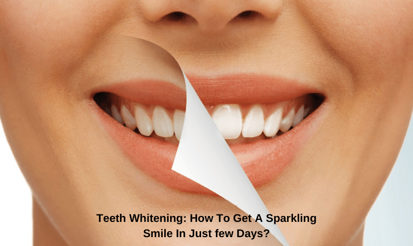 Teeth Whitening