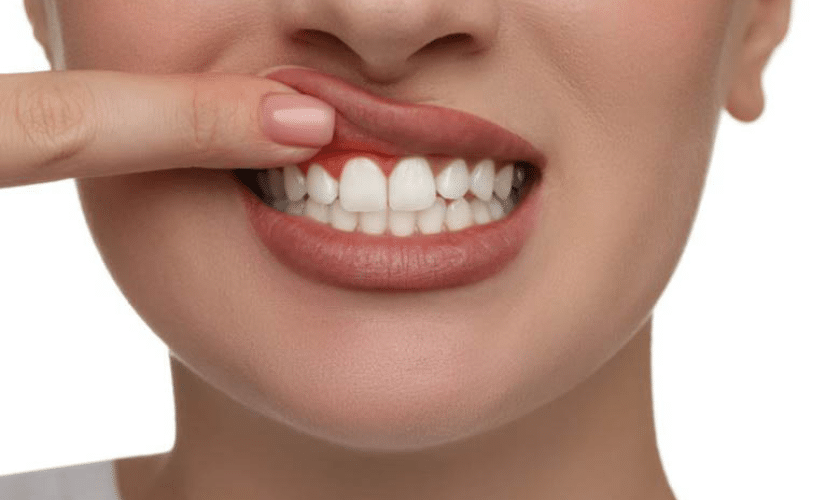 Effective Gum Disease Treatment Options for a Healthier Smile