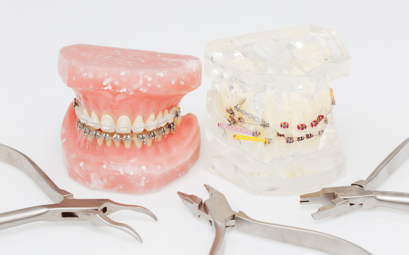 The Evolution Of Orthodontic Technology And Techniques