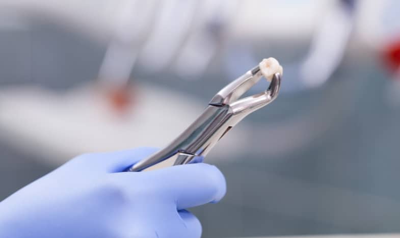 Featured image for “How To Tell If A Tooth Needs To Be Extracted?”