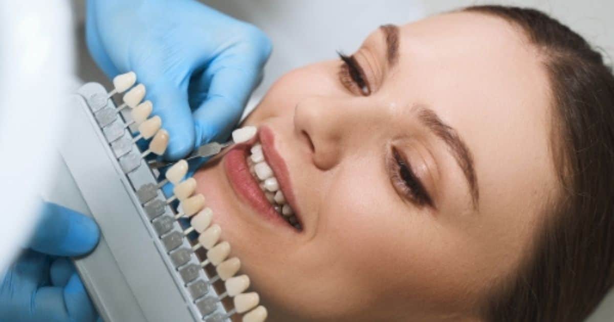 Featured image for “Holistic Cosmetic Dentistry: Why Gold River Patients Want Metal-Free Smiles”