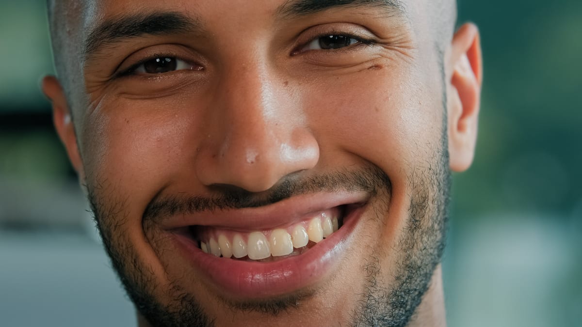 Featured image for “Dental Crowns in Rancho Cordova, CA | River Family Dentistry”